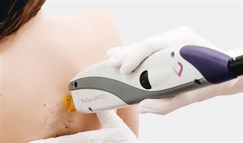 What are these black or red spots on my testicles and how do I get rid of them? Angiokeratomas ...