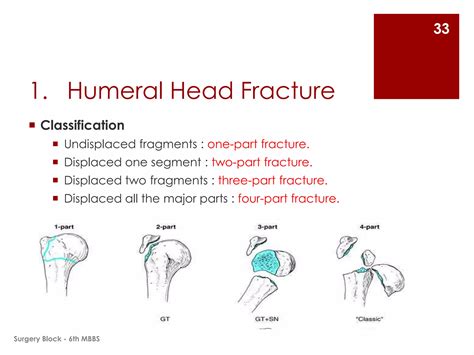 Fractures and Dislocations of Upper Limb | PPTX