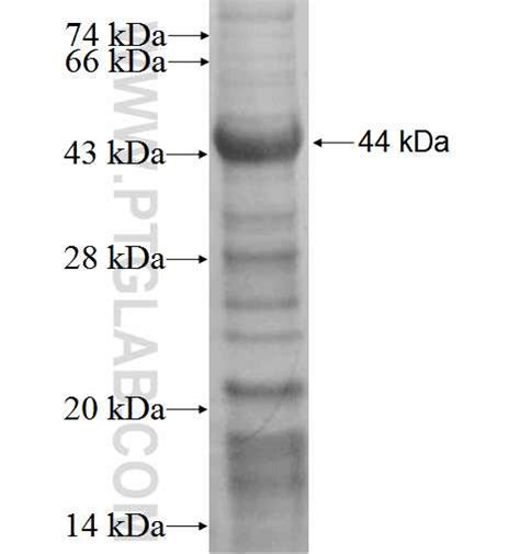 DPP8 Fusion Protein Ag3262 | Proteintech