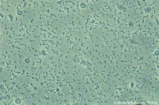 tappeto di emazie bacteria fungi tappeto di emazie bacteria fungi