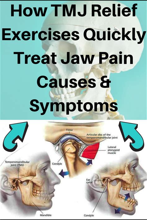 Image result for TMJ Relief Exercises