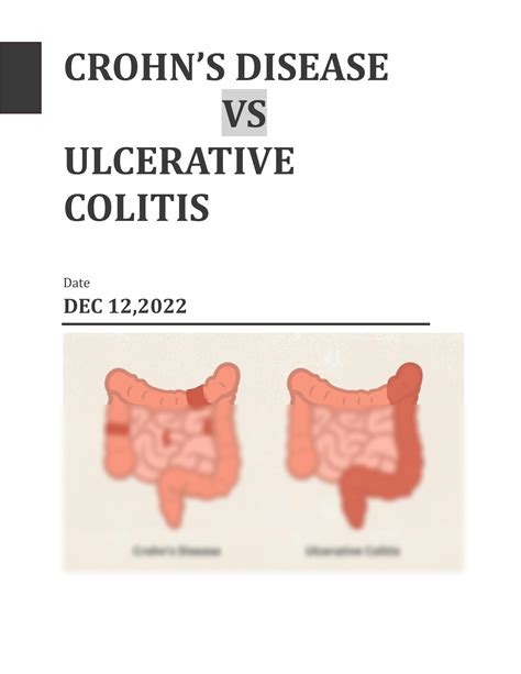 SOLUTION: Crohn s disease vs ulcerative colitis - Studypool