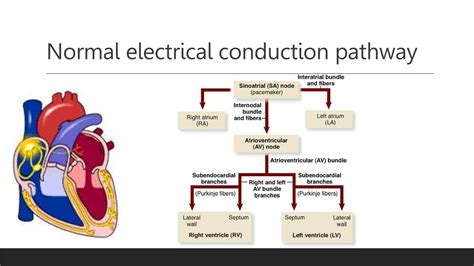 Ventricular preexcitation syndrome.pptx
