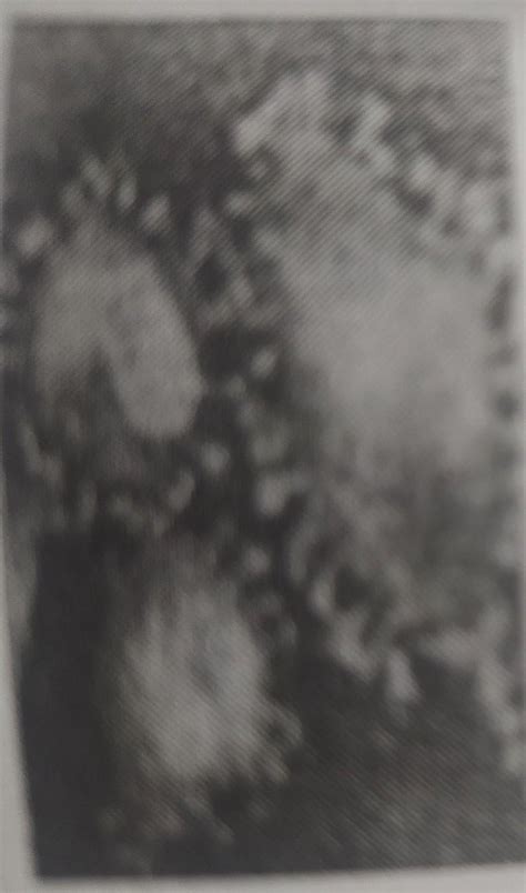 Identify the microorganism shown in the picture below. Mention one ...