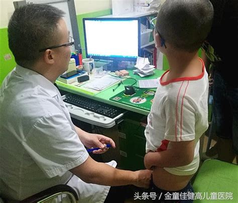 重庆做包皮医院“张氏包皮环切术”效果就是不一样-搜狐