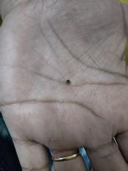 Buy WARTOSIN Wart, Massa and Skin Tags Removal Herbal and Ayurvedic ...