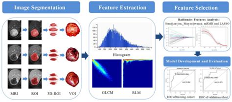 MRI-Based Radiomics Models to Discriminate Hepatocellular Carcinoma and ...