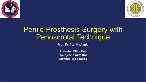 Penile Prosthesis Surgery with Penoscrotal Technique