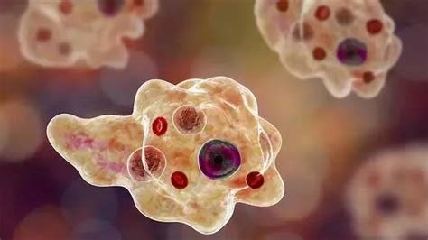 Brain eating amoeba; disease has changed a lot compared to previous ...