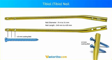 Intramedullary Nail Tibia 的图像结果