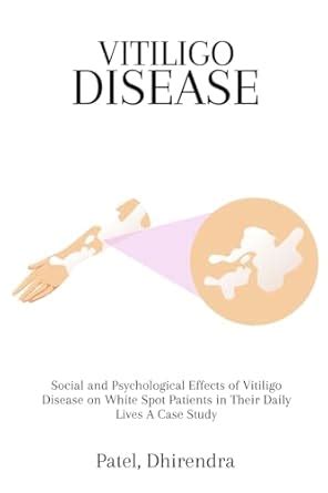 Buy Social and Psychological Effects of Vitiligo Disease on White Spot ...