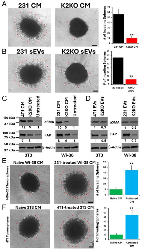Role of Kindlin-2-Expressing Extracellular Vesicles in the Invasiveness ...