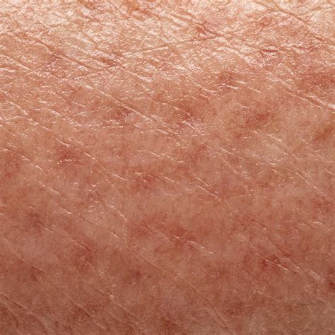 Callidus™ Care – Premium Skincare for Acne & Brightening – Calliduscare