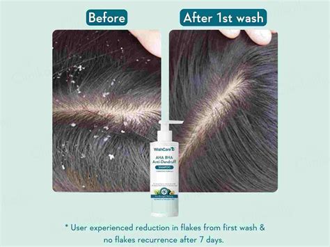 Buy WishCare AHA BHA Anti-Dandruff Shampoo Online | Clinikally