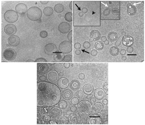 Lyophilization of Liposomal Formulations: Still Necessary, Still ...