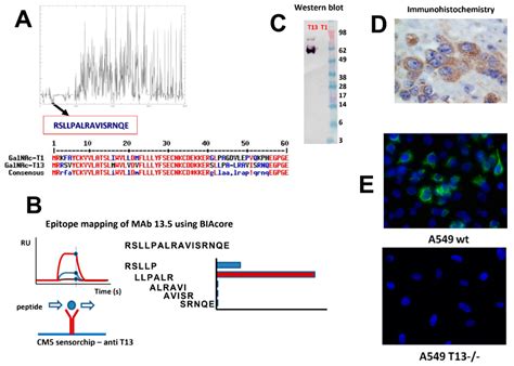Polypeptide-GalNAc-Transferase-13 Shows Prognostic Impact in Breast Cancer