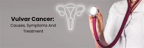 Vulvar Cancer: Causes, Symptoms & Treatment Guide