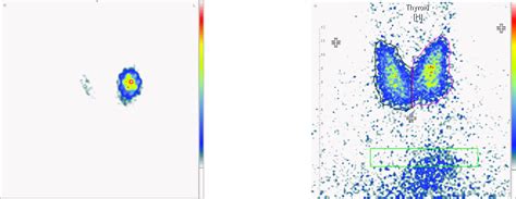 Nuklearmedizin · Medizinische Physik