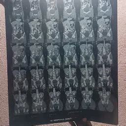 Dr. Sree Kanth Matcha - Proctologist | Laparoscopy | Vascular | Piles ...