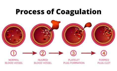 Image result for Coagulation Pathway Explained