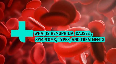 Kidney failure: symptoms, causes, and treatment