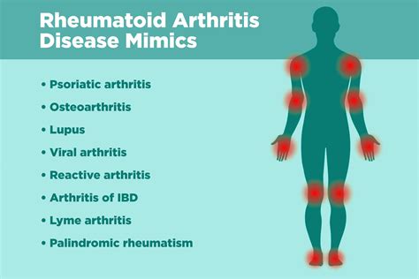 Early Signs Symptoms Of Rheumatoid Arthritis Dr Seyi