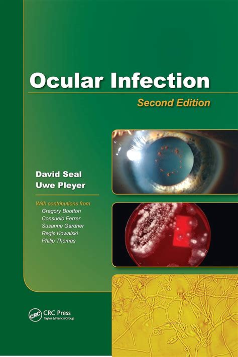 Buy Ocular Infection: Investigation and Treatment in Practice Book ...
