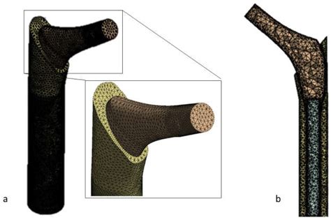 A Finite Element Analysis Study of Influence of Femoral Stem Material in Stress Shielding in a ...
