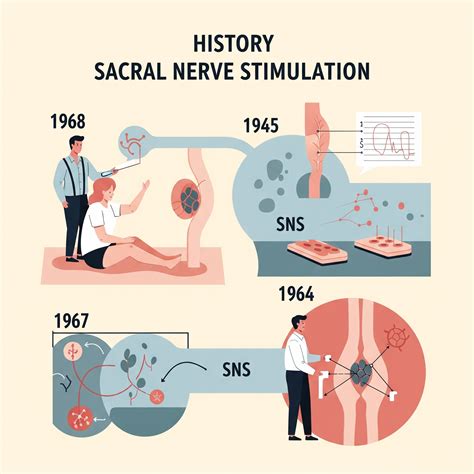 Stunning Benefits of Sacral Nerve Stimulation for Healthcare Professionals
