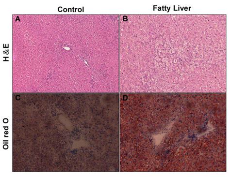 Low Expression of Sirtuin 1 in the Dairy Cows with Mild Fatty Liver ...