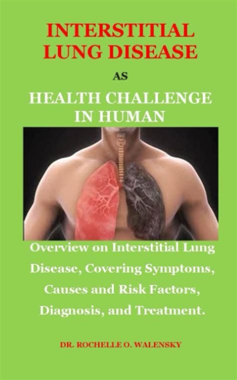 Buy INTERSTITIAL LUNG DISEASE AS CHALLENGE IN HUMAN: OVERVIEW ON ...