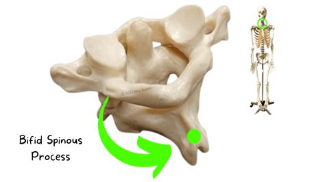Axial Skeleton Anatomy Flashcards – Bio in a flash