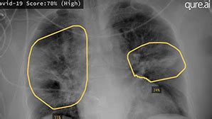 Medical Imaging Augmented with AI | NVIDIA
