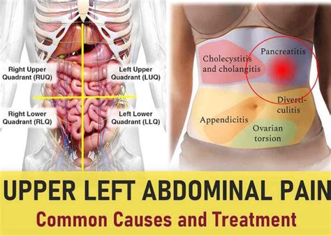Left Side 的图像结果