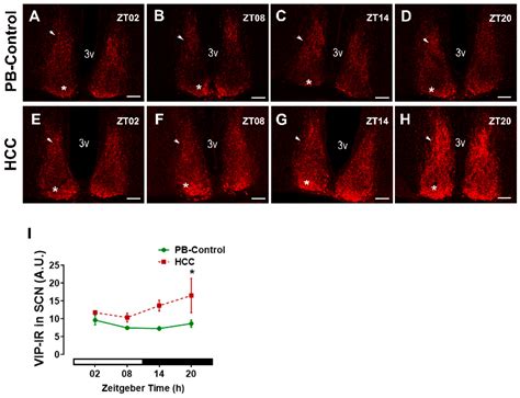 Hepatocellular Carcinoma in Mice Affects Neuronal Activity and Glia ...