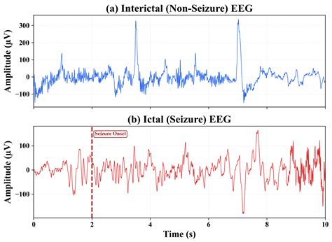 Explainable AI-Enhanced Ensemble Protocol Using Gradient-Boosted Models ...