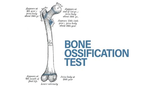Demystifying The Bone Ossification Test In Criminal Jurisprudence