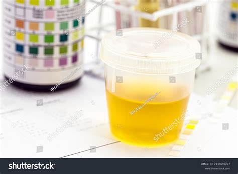 Ketones In Urine