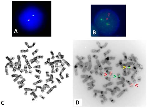 Optical Genome Mapping Reveals Complex and Cryptic Rearrangement ...
