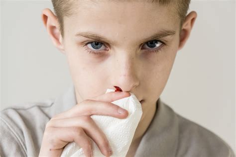经常大量流鼻血会导致死吗？-