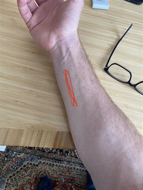 Forearm Muscle Pain Hand, Wrist, Forearm, And Elbow Muscle Imbalances