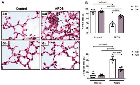 Glutamine Therapy Reduces Inflammation and Extracellular Trap Release ...