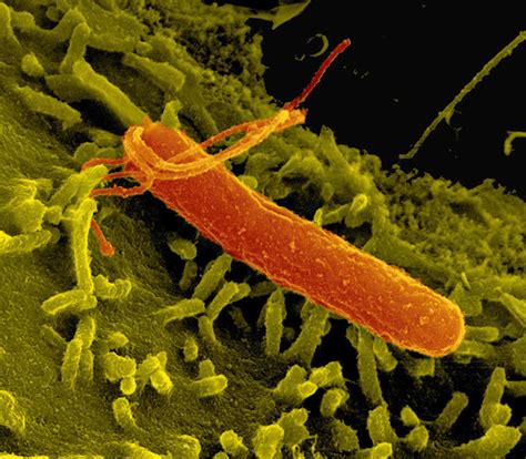 Helicobacter Pylori Infection, Bacteria - Symptoms, Test, Treatment
