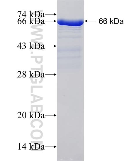 BCL9 Fusion Protein Ag19158 | Proteintech