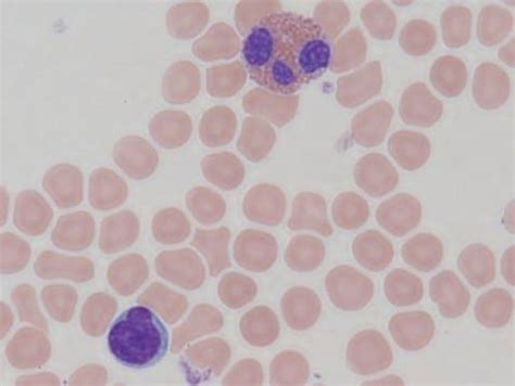 Wright-Giemsa Stain HARLECO® Polychromic stain for peripheral blood and ...