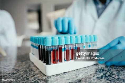 348 Specimen Collection Tubes Stock Photos, High-Res Pictures, and Images - Getty Images