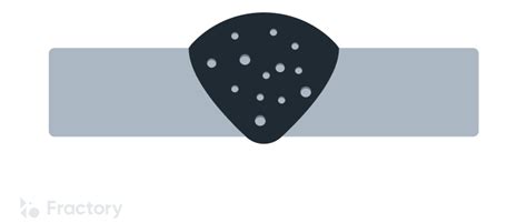 Image result for Types of Defects