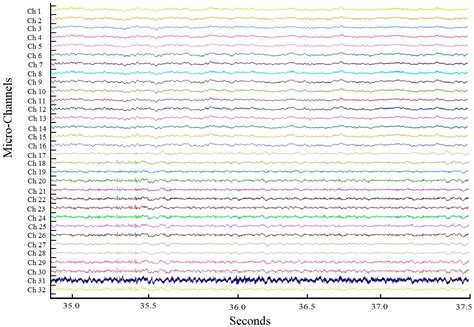 Handcrafted Electrocorticography Electrodes for a Rodent Behavioral Model