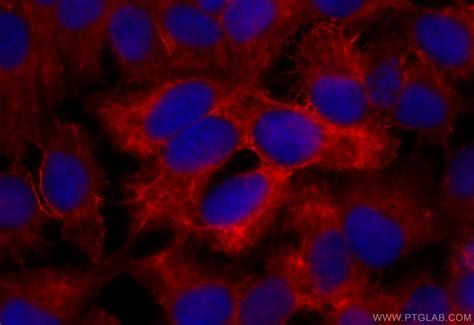 Cytokeratin 13 antibody (CL594-66684) | Proteintech