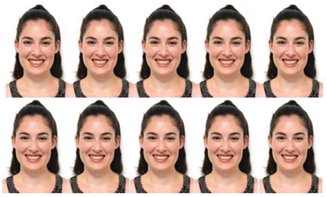 Impact of Dental Midline Shift on the Perception of Facial ...
